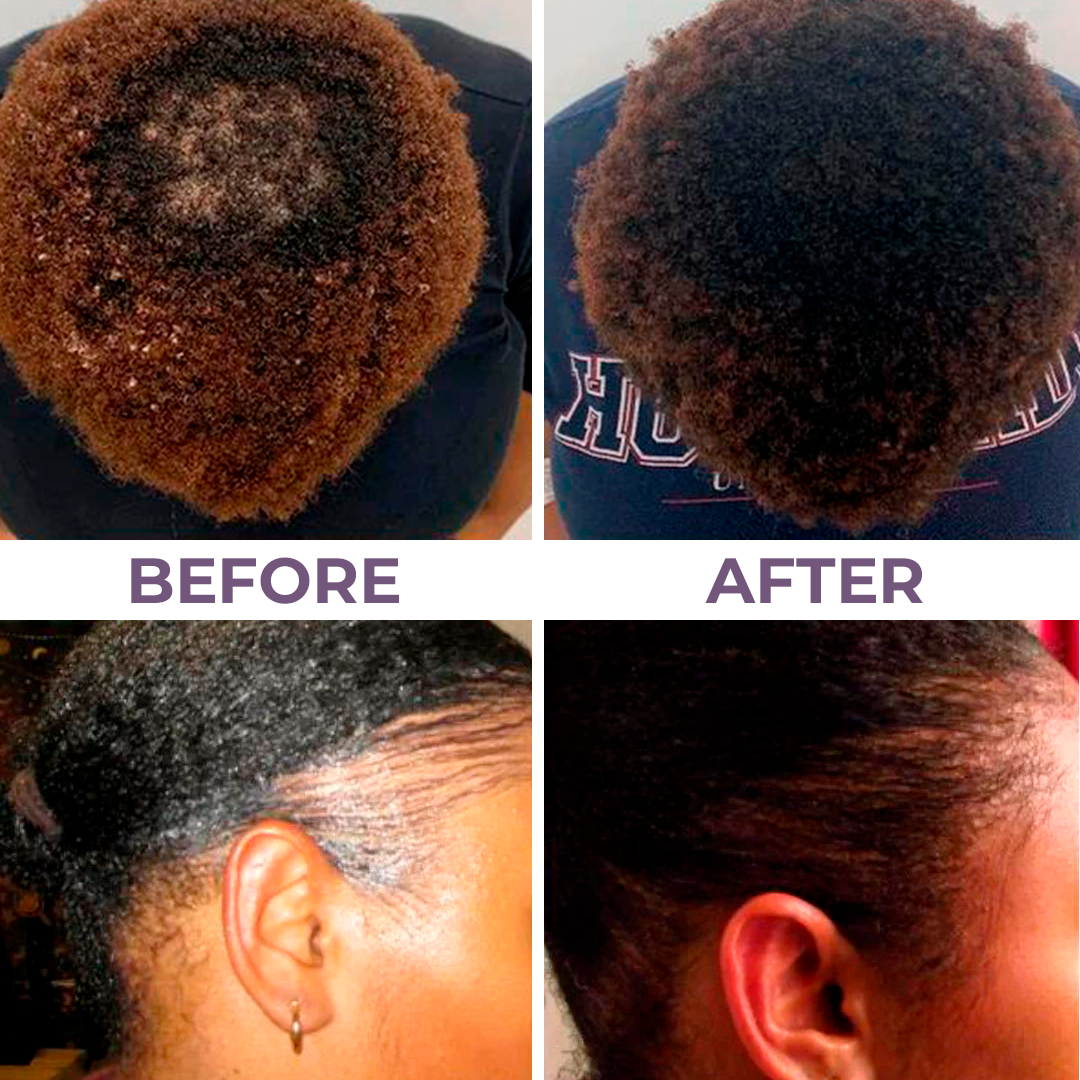 Gro-it edge & hair growth serum